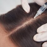 Абонемент мезотерапии лица