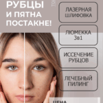 Комплексное удаление рубцов и пятен постакне