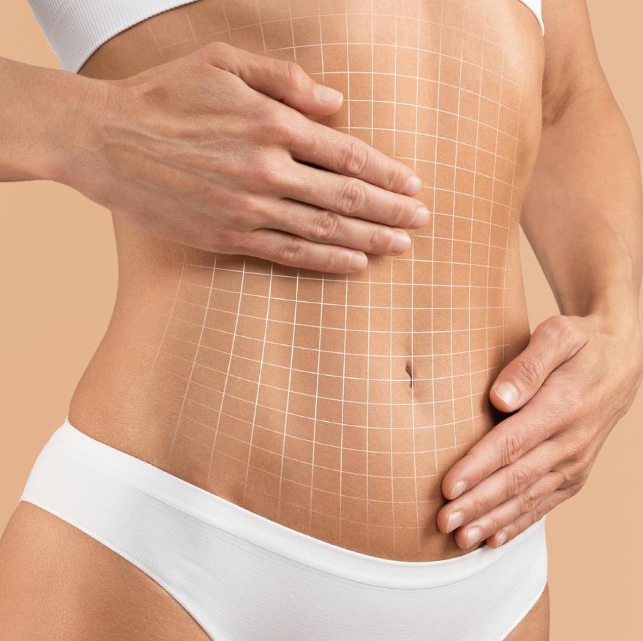 Радиочастотная липосакция