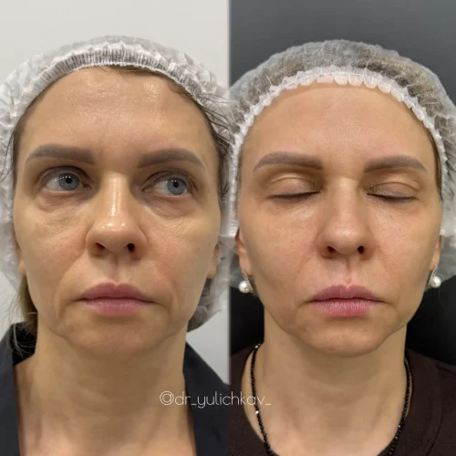 c53773ba-92d3-4f23-8025-800f58b5fc48 (1)